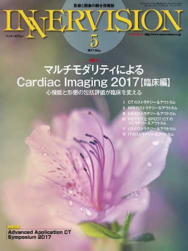 INNERVISION（インナービジョン） 2017年5月号 (発売日2017年05月01日) 表紙