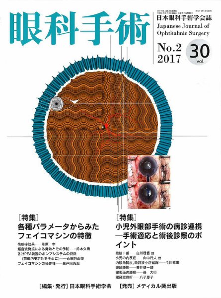 眼科手術 Vol.30 No.2 (発売日2017年04月30日) 表紙