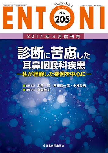 ENTONI（エントーニ） 2017年4月増刊号 (発売日2017年04月25日) 表紙