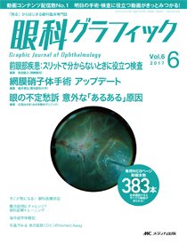 眼科グラフィック 2017年6号 (発売日2017年11月15日) 表紙
