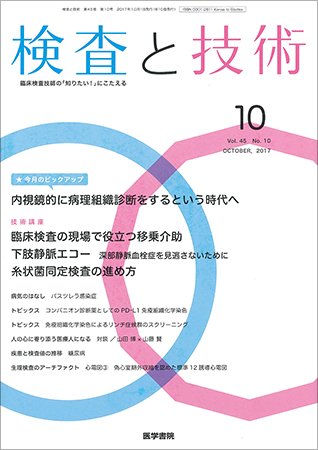 検査と技術 Vol.45 No.10 (発売日2017年10月01日) 表紙