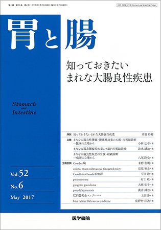 胃と腸 Vol.52 No.6 (発売日2017年05月25日) 表紙