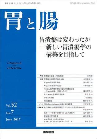 胃と腸 Vol.52 No.7 (発売日2017年06月25日) 表紙