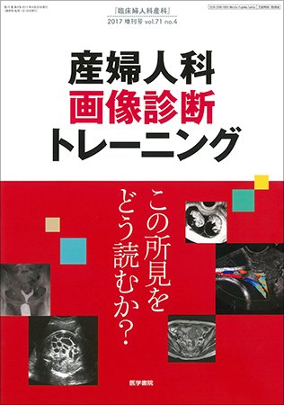 臨床婦人科産科 Vol.71 No.4 (発売日2017年04月20日) 表紙
