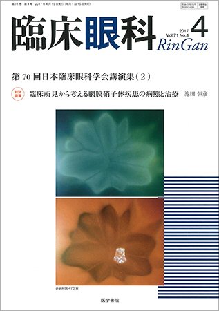 臨床眼科 Vol.71 No.4 (発売日2017年04月15日) 表紙