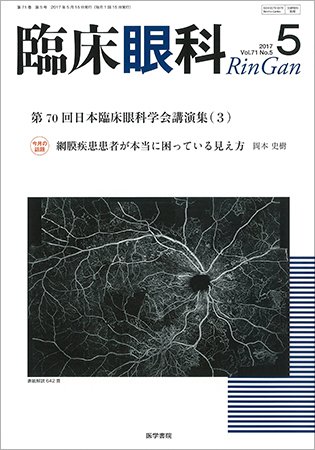 臨床眼科 Vol.71 No.5 (発売日2017年05月15日) 表紙