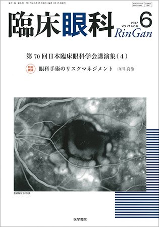 臨床眼科 Vol.71 No.6 (発売日2017年06月15日) 表紙
