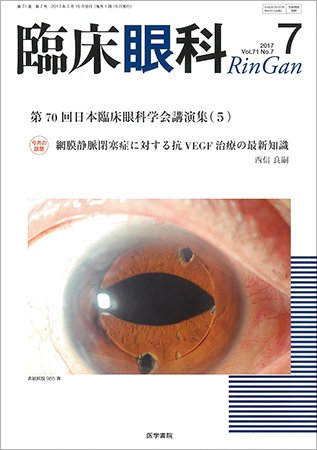 臨床眼科 Vol.71 No.7 (発売日2017年07月15日) 表紙