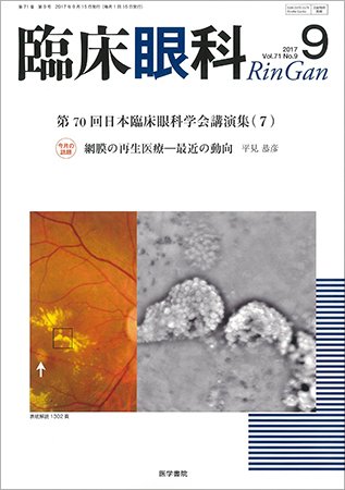 臨床眼科 Vol.71 No.9 (発売日2017年09月15日) 表紙