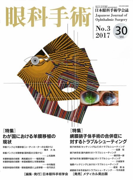 眼科手術 Vol.30 No.3 (発売日2017年07月30日) 表紙