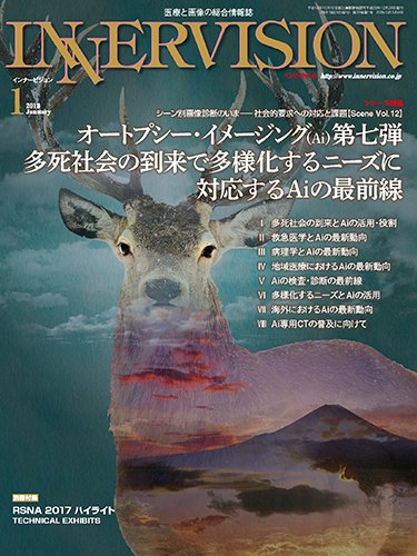 INNERVISION（インナービジョン） 2018年1月号 (発売日2018年01月01日) 表紙