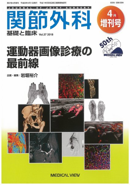 関節外科 4月増刊号 (発売日2018年04月04日) 表紙