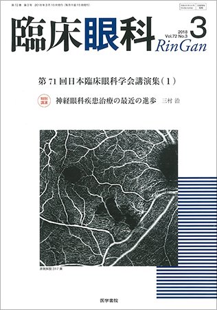 臨床眼科 Vol.72 No.3 (発売日2018年03月15日) 表紙