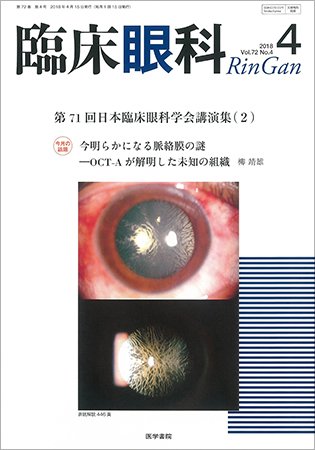 臨床眼科 Vol.72 No.4 (発売日2018年04月15日) 表紙