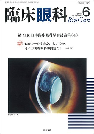 臨床眼科 Vol.72 No.6 (発売日2018年06月15日) 表紙