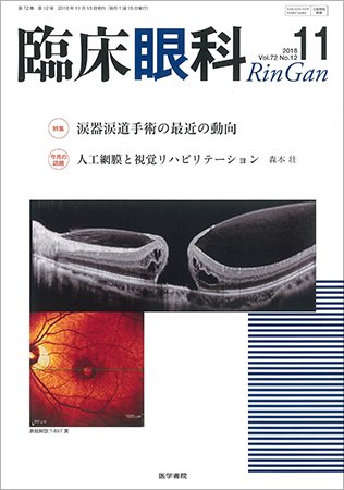 臨床眼科 Vol.72 No.12 (発売日2018年12月15日) 表紙