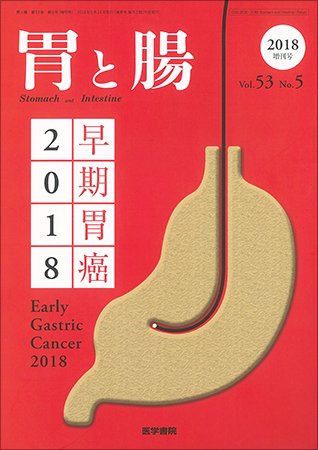 胃と腸 Vol.53 No.5 (発売日2018年05月10日) 表紙