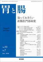 胃と腸 Vol.53 No.7 (発売日2018年06月25日) 表紙