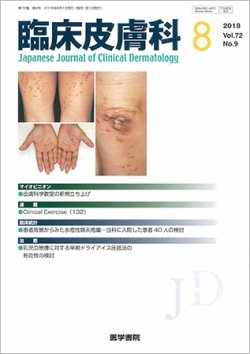 臨床皮膚科 Vol.72 No.9 (発売日2018年08月01日) | 雑誌/定期