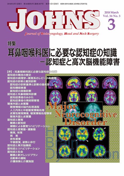 JOHNS（ジョウンズ） 18年3月号 (発売日2018年03月01日) 表紙