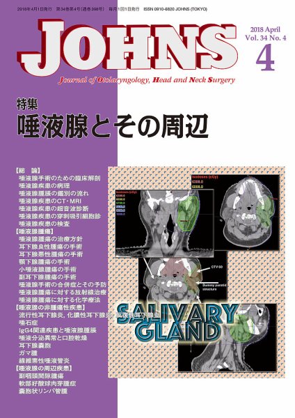 JOHNS（ジョウンズ） 18年4月号 (発売日2018年04月01日) 表紙