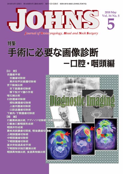 JOHNS（ジョウンズ） 18年5月号 (発売日2018年05月01日) 表紙