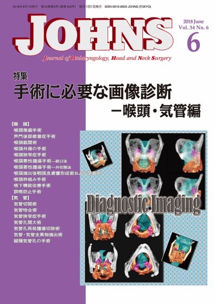 JOHNS（ジョウンズ） 18年6月号 (発売日2018年06月01日) 表紙