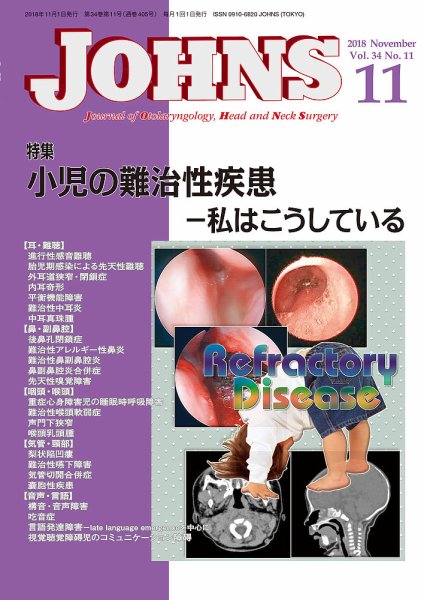 JOHNS（ジョウンズ） 18年11月号 (発売日2018年11月01日) 表紙
