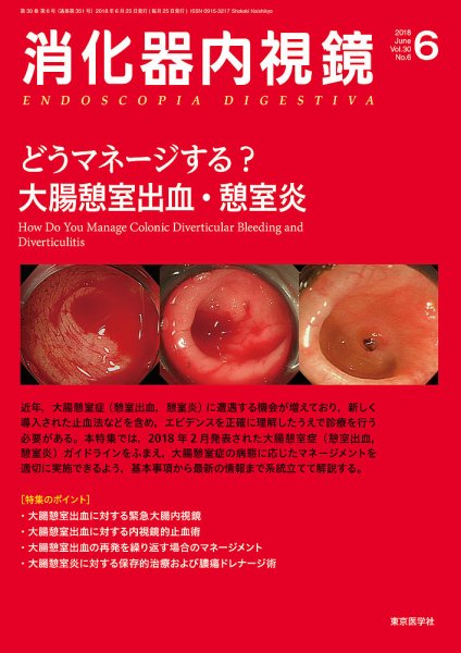 消化器内視鏡 18年6月号 (発売日2018年06月25日) 表紙