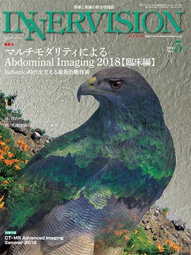 INNERVISION（インナービジョン） 2018年5月号 (発売日2018年05月01日) 表紙
