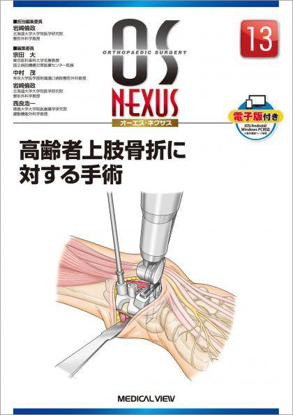 OS NEXUS（オーエス　ネクサス） No.13 (発売日2018年01月30日) 表紙