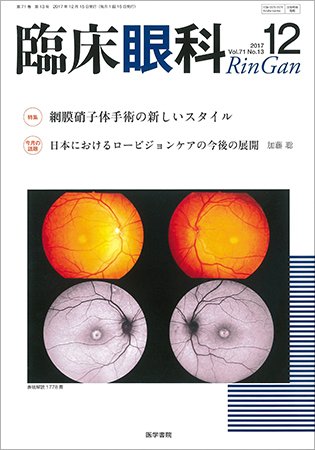 臨床眼科 Vol.71 No.13 (発売日2017年12月15日) 表紙