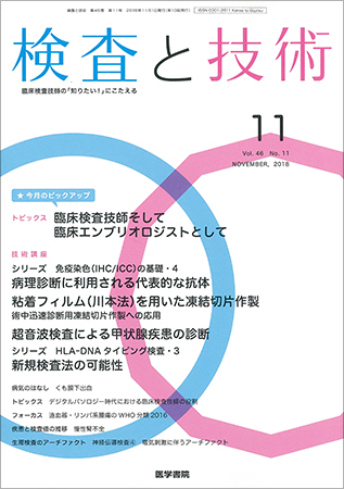 検査と技術 Vol.46 No.11 (発売日2018年11月01日) | 雑誌/定期購読の