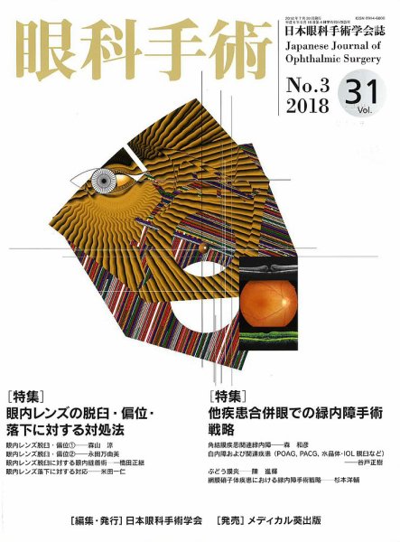 眼科手術 Vol.31 No.3 (発売日2018年07月30日) 表紙