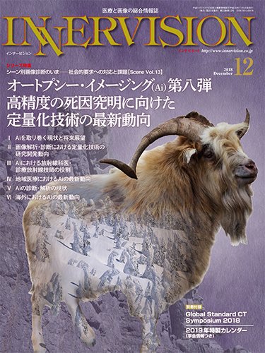 INNERVISION（インナービジョン） 2018年12月号 (発売日2018年12月01日) 表紙