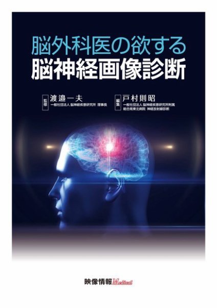 脳外科医の欲する脳神経画像診断 2018年06月15日発売号 表紙