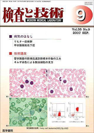 検査と技術 Vol.35 No.9 (発売日2007年09月01日) 表紙
