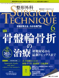 整形外科サージカルテクニック 2019年6号 (発売日2019年11月15日) 表紙