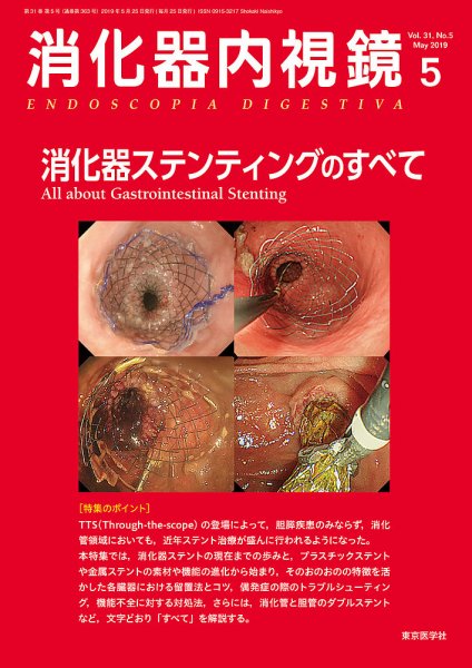 消化器内視鏡 19年5月号 (発売日2019年05月25日) 表紙
