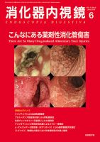 消化器内視鏡 Vol.31 No.6(201 こんなにある薬剤性消化管傷害 消化器内視鏡編集委員会 消化器内視鏡33巻2021年増刊号 消化管内視鏡治療-基本から高難度