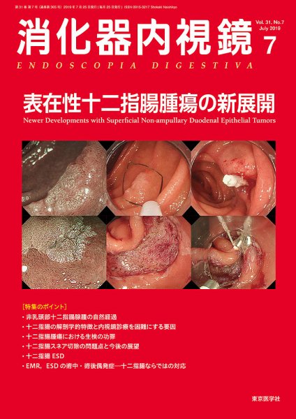 消化器内視鏡 19年7月号 (発売日2019年07月25日) | 雑誌/定期購読の