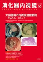 消化器外科 2019年 10 月号 [雑誌] 消化器内視鏡 19年10月号 (発売日2019年10月25日) | 雑誌/定期
