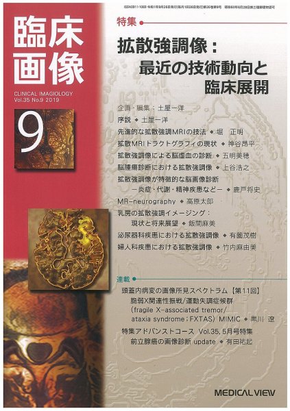 臨床画像 2019年9月号 (発売日2019年08月26日) 表紙