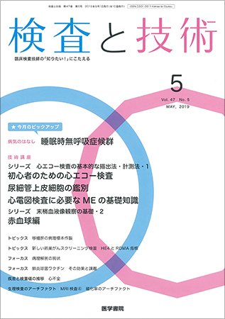 検査と技術 Vol.47 No.5 (発売日2019年05月01日) 表紙