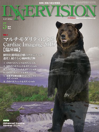 INNERVISION（インナービジョン） 2019年5月号 (発売日2019年05月01日) 表紙