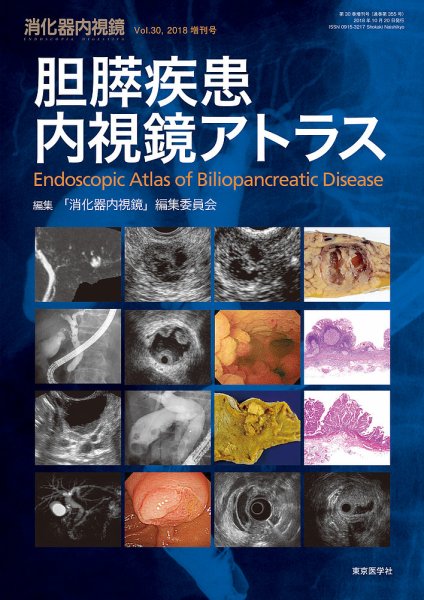消化器内視鏡 18年30巻増刊号 (発売日2018年10月22日) 表紙