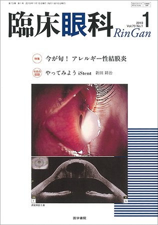 臨床眼科 Vol.73 No.1 (発売日2019年02月15日) 表紙