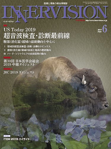 INNERVISION（インナービジョン） 2019年6月号 (発売日2019年06月01日) 表紙