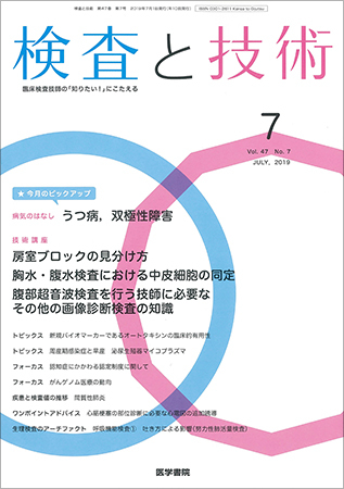 検査と技術 Vol 47 No 7 発売日19年07月01日 雑誌 定期購読の予約はfujisan 検査と技術 Vol 47 No 7 発売日19年07月01日 雑誌 定期購読の予約はfujisan