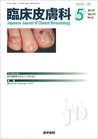 臨床皮膚科 Vol.73 No.6 (発売日2019年05月25日) 表紙